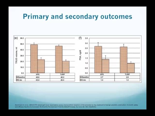June 8, 2016 - Presentations by Visiting Students: Robert D. Fisher “Comparing Surgical Options for Benign Prostatic Hyperplasia” Xinan Chen "Microbubble: A Novel Treatment of Kidney Stones”
