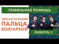 Правильная помощь.  Кровотечение, ампутация и обморок | Разборы 2