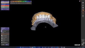 Expert 3D Modeling of Zirconia Crown Cutback - Exocad design