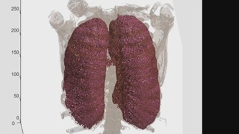 3D Volumetric Image Processing Demo - MATLAB Video