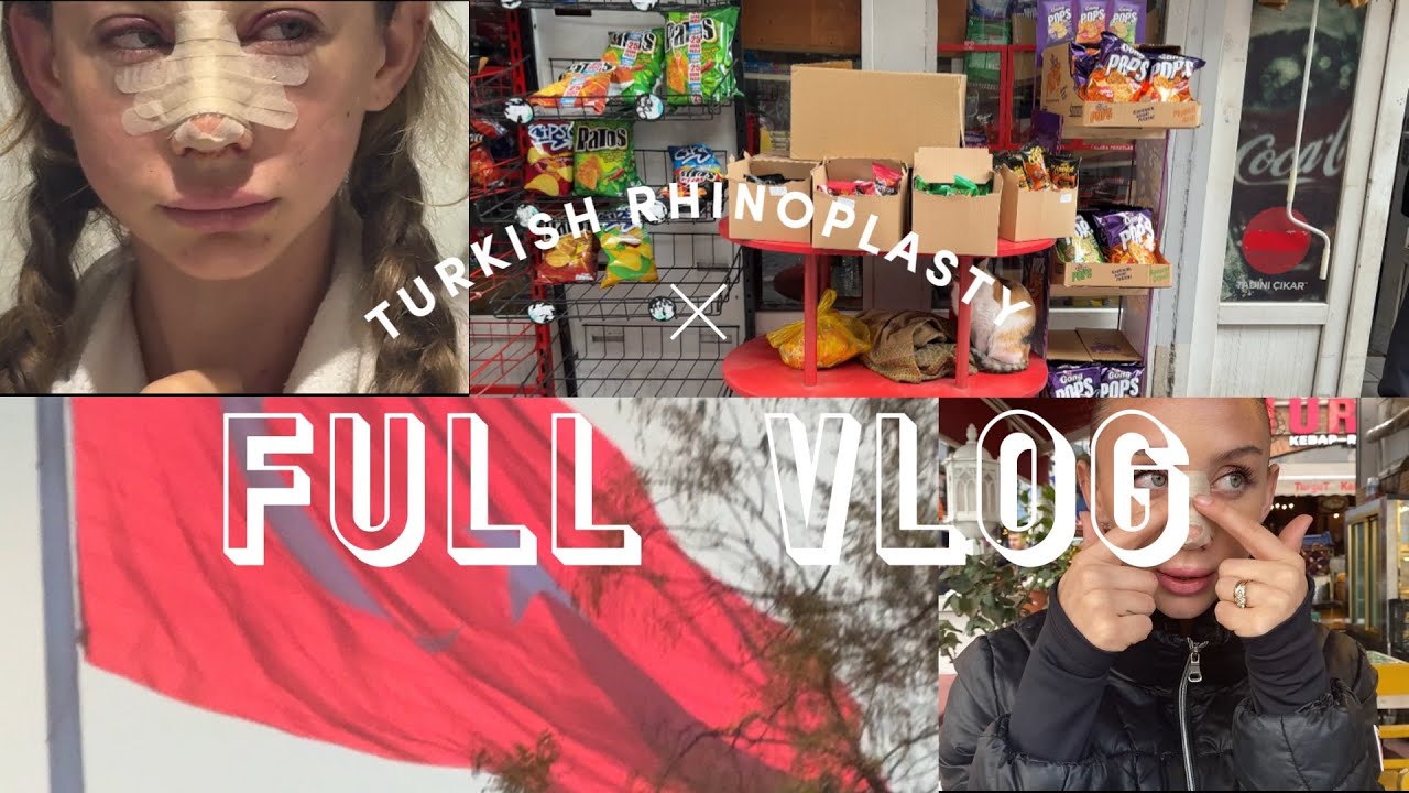 I FLEW TO ISTANBUL FOR A NOSE JOB | full vlog