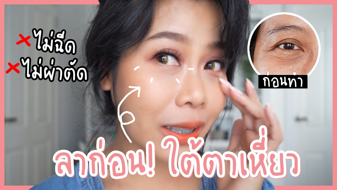 อาย ครีม ขั้น เทพ ลด ริ้ว รอย  New  รีวิวการทำ Thermage ใต้ตา เจ็บมั้ย ใต้ตาหายเหี่ยวจริงเหรอ | BEAUTY MOUTHSY