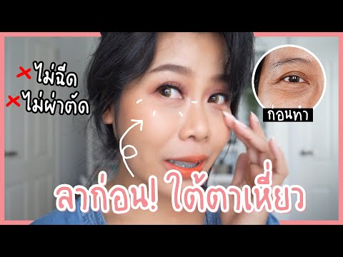 รีวิวการทำ Thermage ใต้ตา เจ็บมั้ย ใต้ตาหายเหี่ยวจริงเหรอ | BEAUTY MOUTHSY