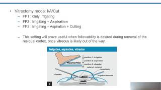 Understanding the Principles of Anterior Vitrectomy