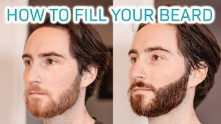Famous How to Fill In A Patchy Beard Net Worth
