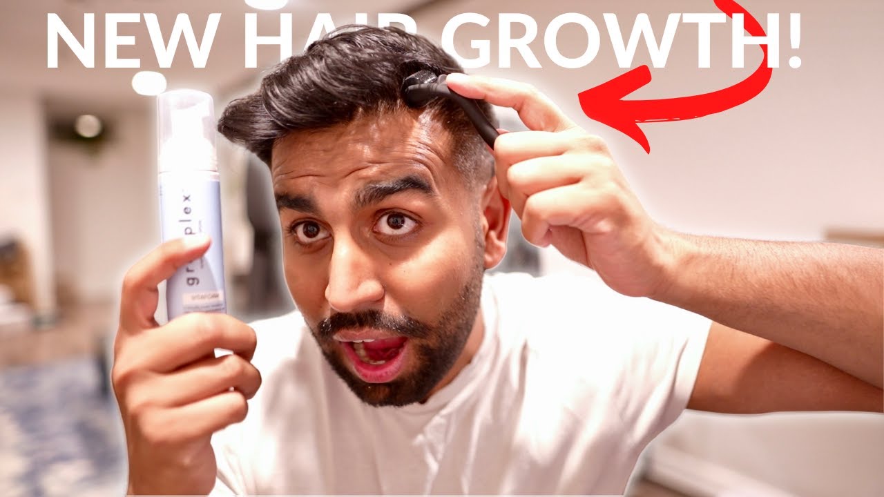 How To Use a Derma Roller and Minoxidil For Hair Growth