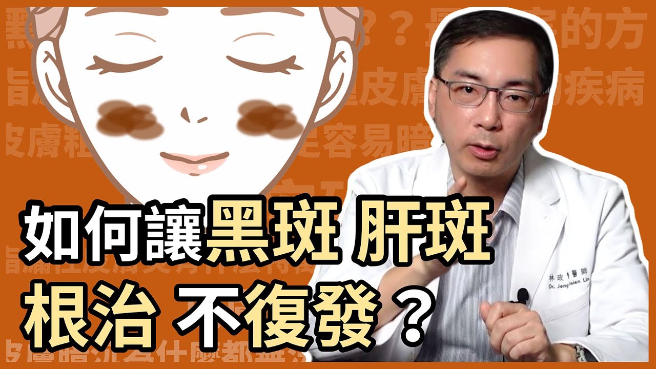 讓黑斑、肝斑根治且不復發的關鍵是？皮膚科林政賢醫師告訴你，如何用矽谷電波進行生態系養膚，打造無斑好膚質！