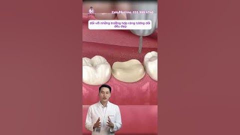 Trường Hợp Nào Nên Bọc Răng Sứ ? Mô Phỏng Quy Trình Bọc Răng Sứ - Bác Sĩ Tài Tử Tế #bacsitaitute