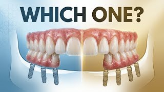 Dental Implants in Turkey: All-on-4 or All-on-6 — Dr. Taslidere Explains