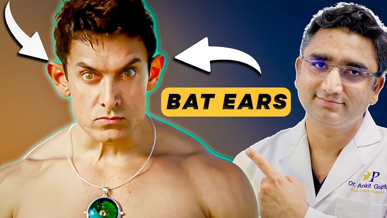 Bat Ears Or Prominent Ears Solution By Dr Ankit Gupta