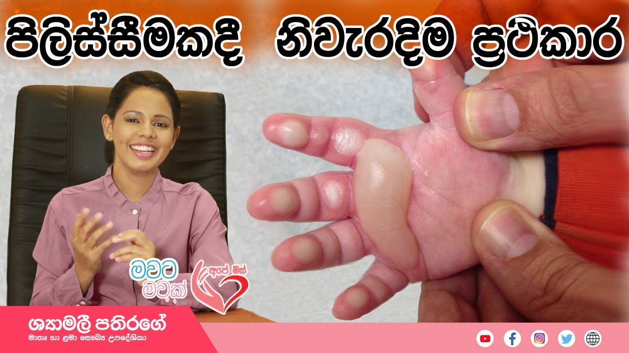 Ape Miss - දරුවා පිලිස්සිනොත් කරන්න ඕන දේ | Shyamalee Pathirage.