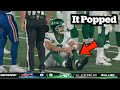 Aaron Rodgers Achilles Snaps - Doctor Explains Injury