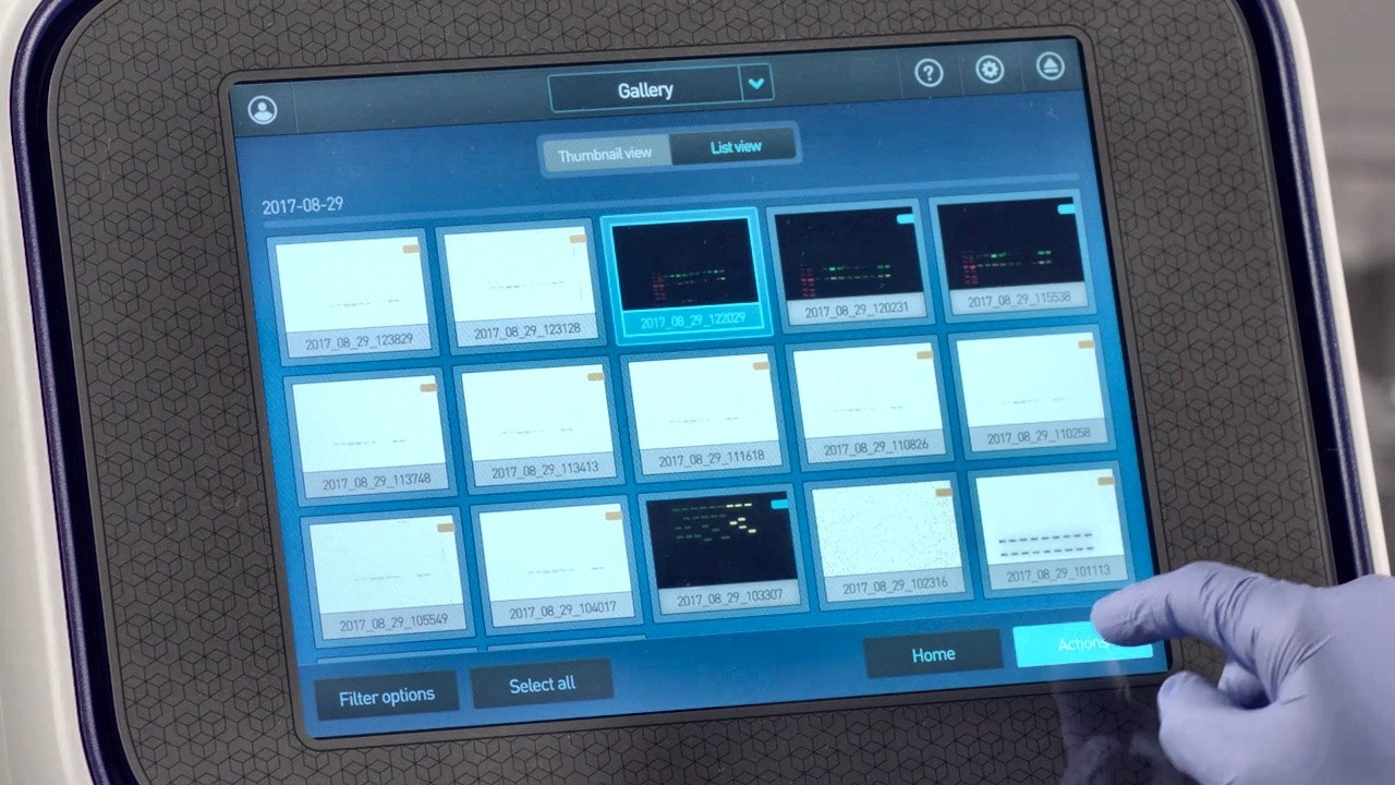 Как быстрее анализировать изображения вестерн-блоттинга | iBright Imaging