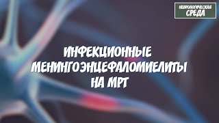 Инфекционные менингоэнцефаломиелиты на МРТ