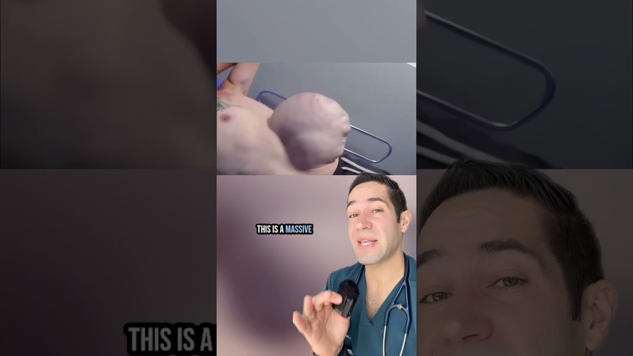 What happened to his stomach?!