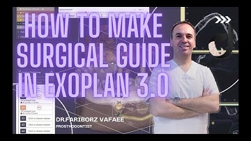 HOW TO MAKE SURGICAL GUIDE IN EXOPLAN3.0 P2