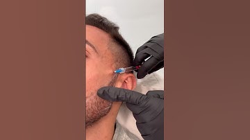 Real “MEWING”! #shelove #mewing #tutorial #trick #aesthetic #shortsviral