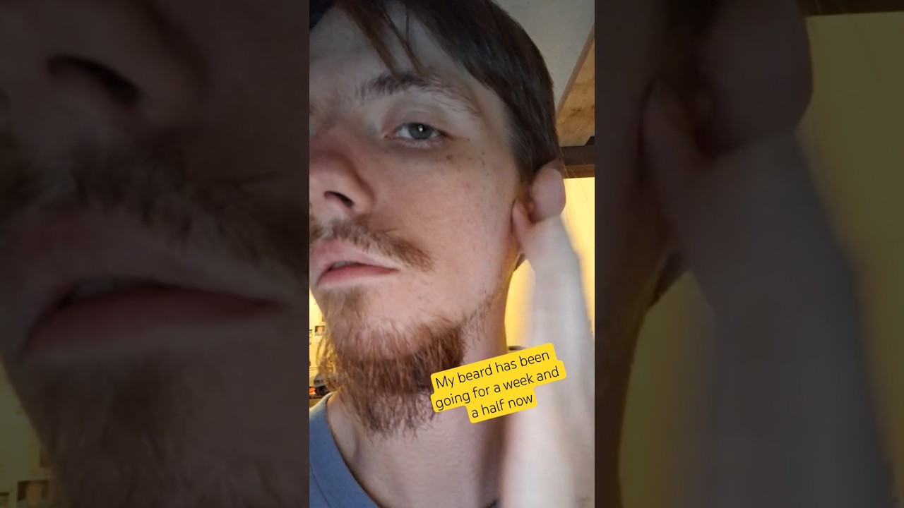 my beard has been growing back for a half a week and now
