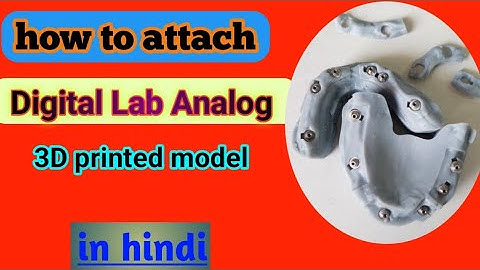 "How to Attach Digital Implant Analog in 3D Printed Model | Dental Lab Tutorial in Hindi"