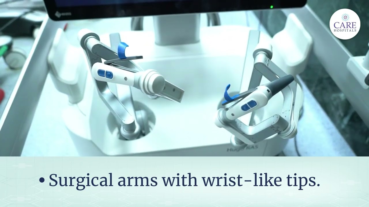 Hugo™ Robot-Assisted Surgery System | CARE Hospitals, Banjara Hills