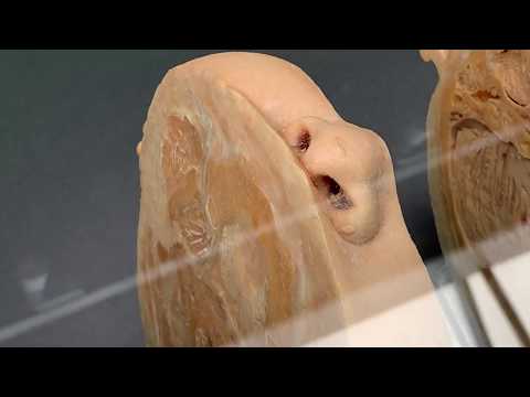 Video: Bảo tàng Giải phẫu. Những cuộc triển lãm gây sốc của các bảo tàng giải phẫu trên thế giới