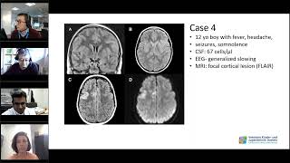 How do I treat Childhood Autoimmune Encephalitis | Tuesday Lunch with RITA