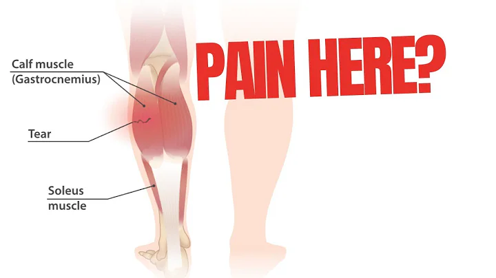 Rehab for Calf muscle strain injury. Tests  and Exercises included