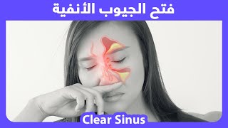 Instant Sinus Drainage - Clear blocked nose | تصريف الجيوب الأنفية بشكل فوري