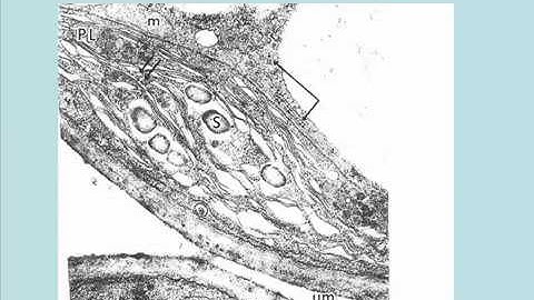 113 Isolated Chloroplasts