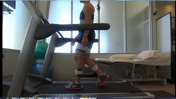 3D Gait Analysis Case Study