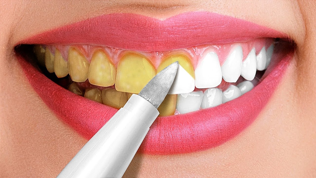 30 Amazing Hacks For A White Smile  Beauty Tricks and Tips