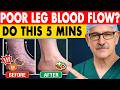 Surgeon Reveals: Poor Leg Circulation? 30-Second Test + 5 Fast Fix Exercises | Senior Health