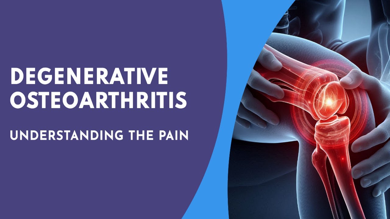 Degenerative Osteoarthritis - Understanding the Pain - YouTube