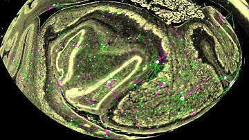 The Human Brain: Images to Atoms