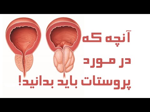 تصویری: آیا می توان حمام بخار گرفت و از یک سونا مبتلا به پروستاتیت بازدید کرد: مزایا و معایب ، نظر پزشکان