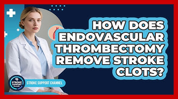 How Does Endovascular Thrombectomy Remove Stroke Clots? - Stroke Support Channel