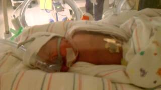 27 weeks twin at Nicu 1