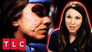 Dr. Emma Treats A Patient With An Extremely Rare Skin Condition | The Bad Skin Clinic