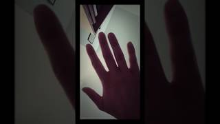Living with Dystonia: tremors in my right hand
