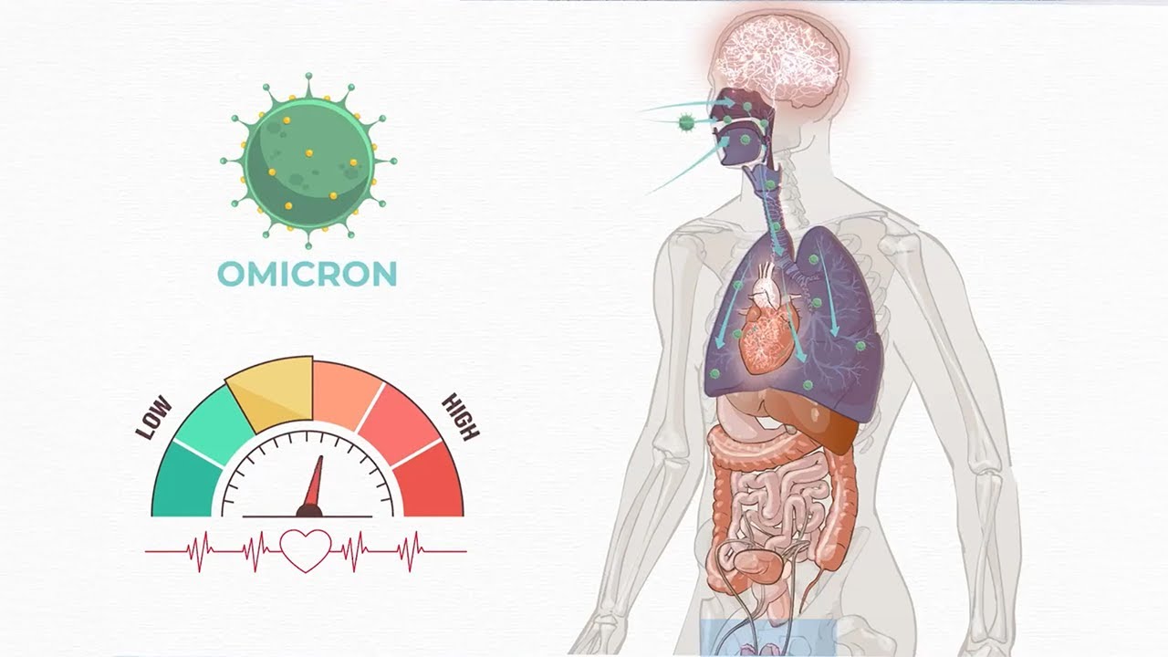 The Long Haul | Long COVID | Medscape - YouTube