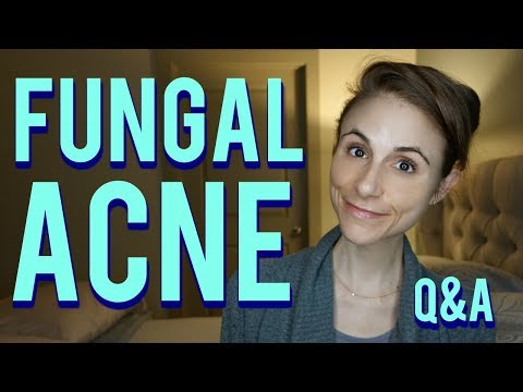 Fungal acne on the face and body| Q&A with Dr Dray