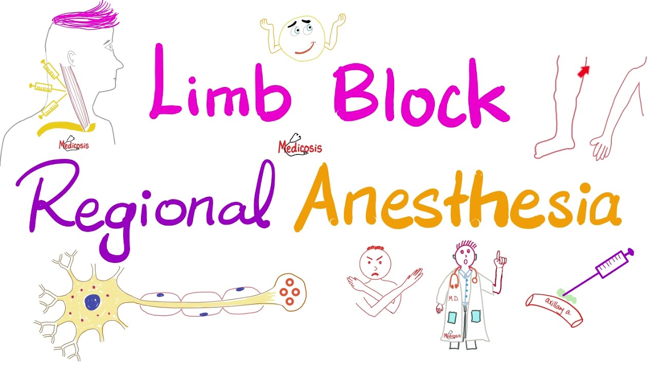 Peripheral Nerve Blocks for Hand Procedures | NEJM