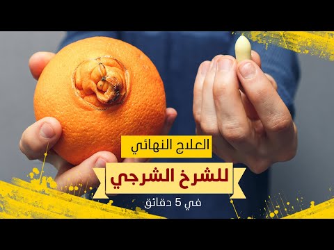 كل ماتريد معرفتة عن الشرخ الشرجي وطريقة العلاج