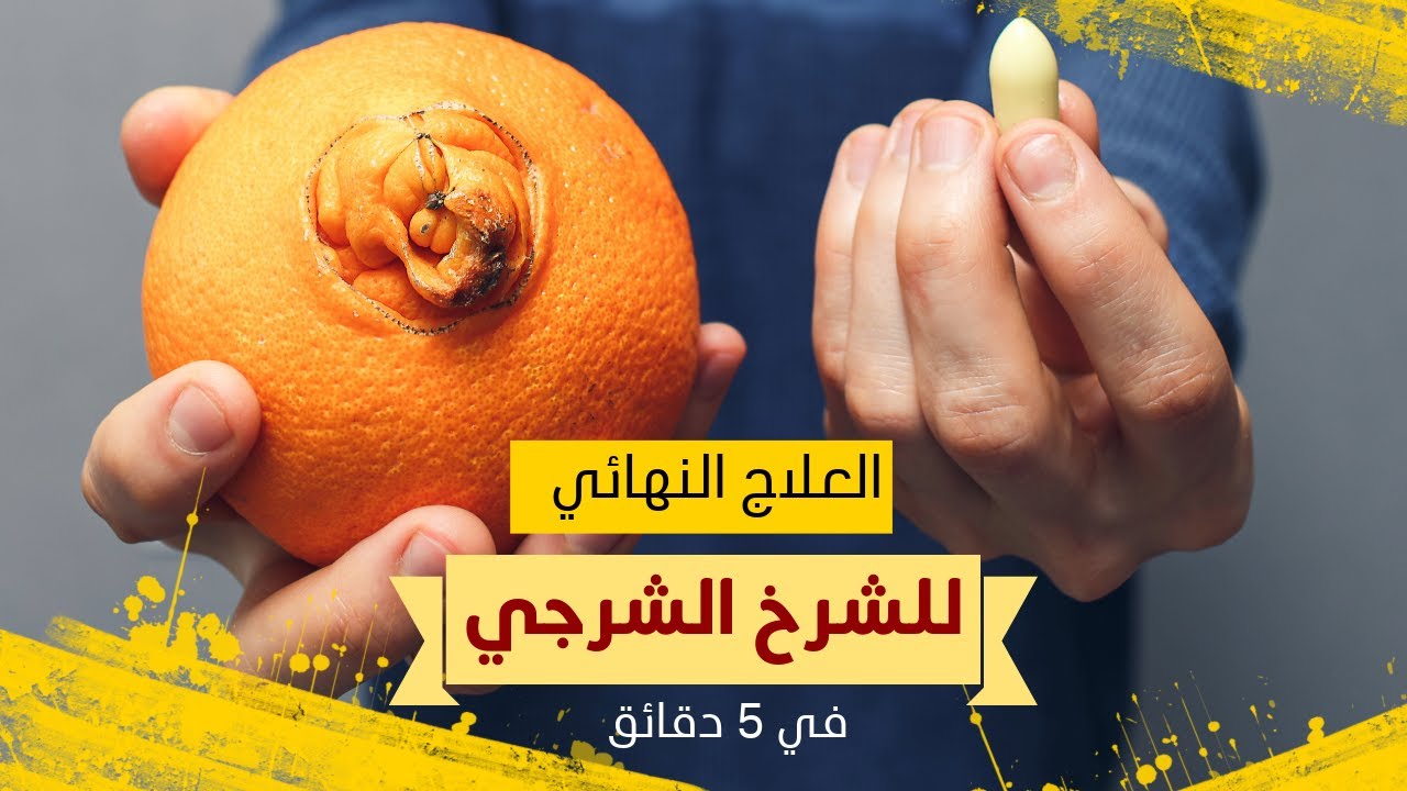 كل ماتريد معرفتة عن الشرخ الشرجي وطريقة العلاج