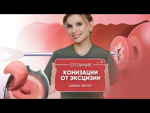 В чем отличие конизации от эксцизии шейки матки
