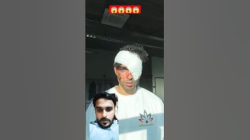 So to answer your question, it didn