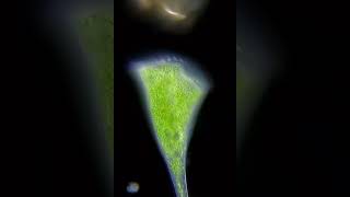 Beneath the surface of a pond.! The microscopic world