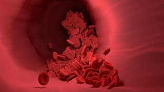 Herbs for Sickle Cell crisis #warming #treating #forpain screenshot 3