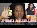 ANEMIA & HAIR LOSS: MY ANEMIA  STORY AND TREATMENT. Anemia, symptoms, treatments etc