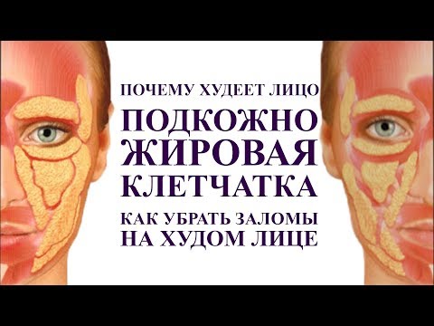 Видео: Можете ли вы уменьшить жировые отложения на лице?